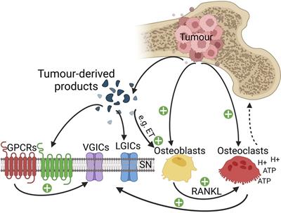 Mechanisms of cancer pain